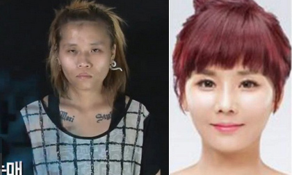 Cô gái từng bị tấn công tình dục 'lên đời' nhan sắc nhờ thẩm mỹ