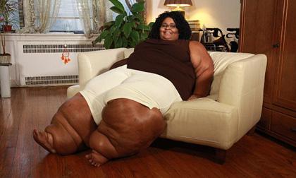 Nỗi khổ của cô gái có chân khổng lồ như chân voi