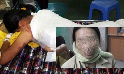 Bị bạo hành suốt 20 năm vẫn kiên quyết không ly hôn và lý do khiến ai cũng phải khâm phục