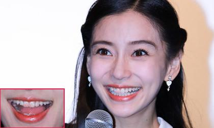 Angela Baby cười hết cỡ không hề biết bị lỗi son dính răng