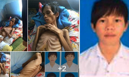 Chàng trai 17 tuổi ở Kon Tum bị đâm vì ghen tuông đã bất ngờ qua đời!