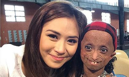 Cô gái Philippines có gương mặt như bà lão đã qua đời ở tuổi 19