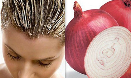 Tóc hết rụng và dày bóng trông thấy nhờ hành tây đỏ