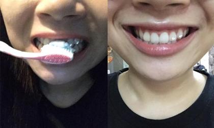 Cách làm trắng răng chỉ tốn 3000 đồng được chia sẻ rầm rộ