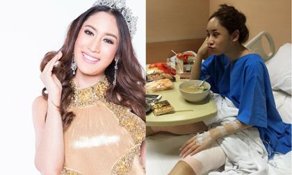  Á hậu Hoàn vũ Thái Lan khoe ảnh phẫu thuật thẩm mỹ