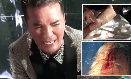 Đàm Vĩnh Hưng bê bết máu ở chân vì trượt ngã vẫn nén đau luyện tập