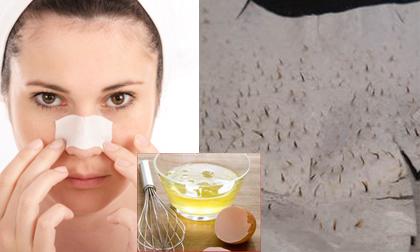 Cách lột mụn an toàn tại nhà bằng những nguyên liệu dễ kiếm