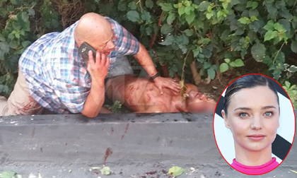 Tiết lộ hình ảnh máu me trong vụ kẻ gian đột nhập nhà của Miranda Kerr