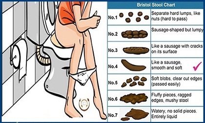 Khi đi vệ sinh 'nặng', đừng quên nhìn vào bồn cầu vì lý do sức khỏe sau
