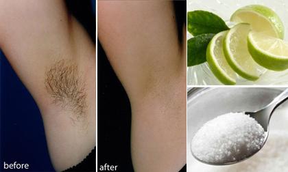 Chỉ cần 2 nguyên liệu này và 2 phút để triệt lông nách vĩnh viễn tại nhà