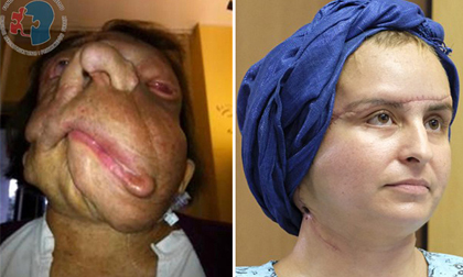 Người phụ nữ mang gương mặt quỷ, 3 năm sau, cô trở nên xinh đẹp đến bất ngờ