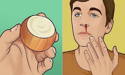 Phương pháp điều trị chảy máu cam