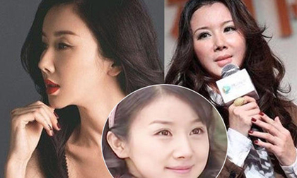 Sao lĩnh 'bản án nghiệt ngã' khi dao kéo mũi