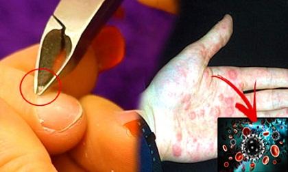 Cô gái bị nhiễm HIV từ việc mà hàng triệu phụ nữ đang làm hàng ngày