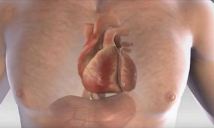 1 tháng trước khi đau tim, cơ thể sẽ có những dấu hiệu này