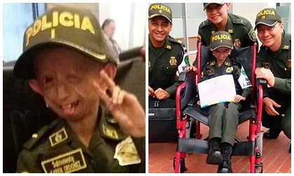 Cô bé 12 tuổi có ngoại hình như bà lão 90 đã qua đời