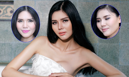 Á hậu Kim Nguyên công khai phẫu thuật thẩm mỹ tại Hiệp Lợi