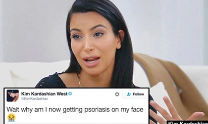 Siêu vòng ba Kim Kardashian 'khốn khổ' vì vảy nến lan lên mặt 