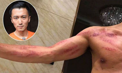 Choáng trước thân hình đỏ lừ bất thường của Tạ Đình Phong 