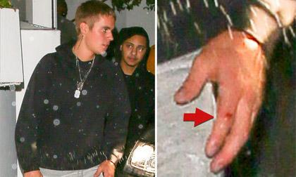 Justin Bieber bị điều tra vụ đánh nhau đến chảy máu ở tiệc tiền Grammy