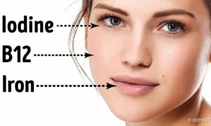 5 dấu hiệu thiếu vitamin hiện rõ mồn một trên khuôn mặt