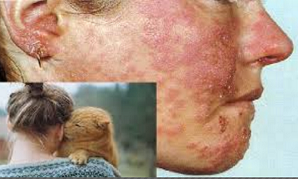 Cảnh báo: Bị mù mắt vì cho mèo liếm mặt