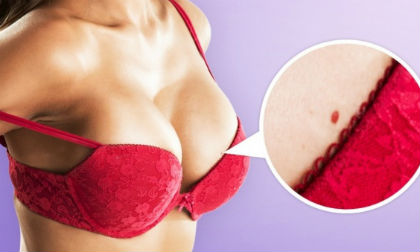 Những đốm đỏ trên da đang báo hiệu điều gì?