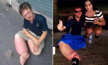 Gã ăn xin người Đức từng bị lật tẩy mánh khóe ở nhiều nước tiếp tục hành nghề tại Sài Gòn