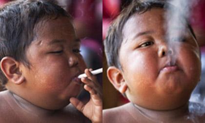 Cậu bé 2 tuổi hút 40 điếu thuốc mỗi ngày khiến thế giới phải sốc giờ ra sao?
