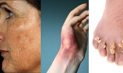 4 biện pháp dân gian giải quyết tất tần tật các vấn đề về da