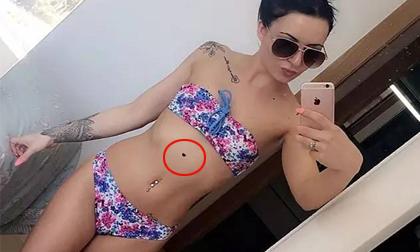 Cô gái trẻ may mắn thoát chết nhờ khoe ảnh mặc bikini lên mạng xã hội