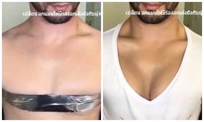 Cách người đàn ông bơm phồng ngực trong tích tắc - Cứu cánh cho hàng loạt phụ nữ ngực lép