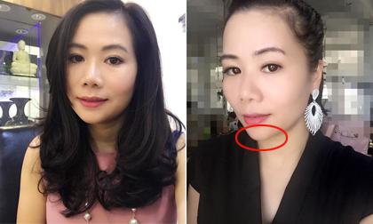 Vợ đại gia kim cương nói gì khi bị nghi phẫu thuật thẩm mỹ?