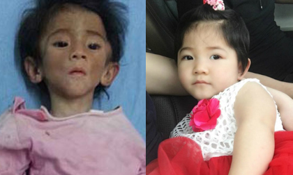 Bất ngờ với bé gái SaPa 14 tháng tuổi nặng 3,5kg 'lột xác' xinh như công chúa