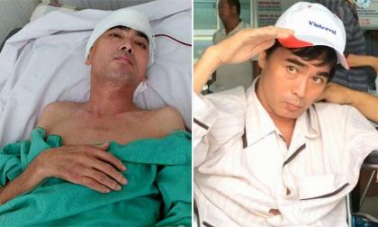 Sau ca mổ não, diễn viên Nguyễn Hoàng lại phải nhập viện vì một chân 'hóa đá'