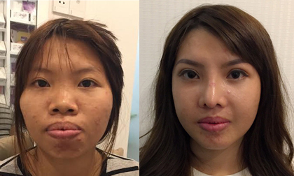 Hành trình làm đẹp của cô gái bị chê ‘chuột chù’