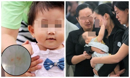 Thay tã cho con 16 tháng tuổi, mẹ hoảng hốt khi biết sự thật 'động trời' sau những vết máu