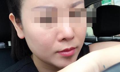 Hậu quả khôn lường của việc phẫu thuật thẩm mỹ qua lời kể của người trong cuộc