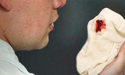 Những triệu chứng ung thư giai đoạn đầu mà 90% mọi người thường bỏ qua