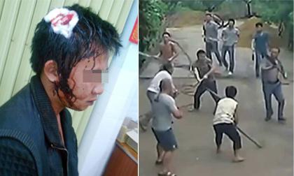 Tưởng về nhà bạn gái được đón tiếp nồng hậu ai ngờ tôi bị bố em đánh tối tăm mặt mũi 