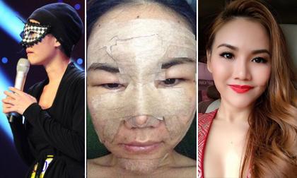 Sau 3 năm, thí sinh đeo mặt nạ mang tiếng lừa bịp của X-Factor lột xác ngoạn mục nhờ thẩm mỹ