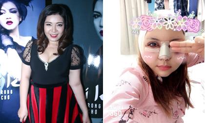 Á quân The Voice mùa đầu tiên công khai gương mặt đỏ tấy, sưng húp vừa 'đập đi làm lại'