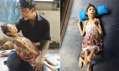 Xót xa trước hình ảnh thiếu nữ 21 tuổi chỉ có da bọc xương vì mắc bệnh hiểm nghèo