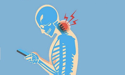 Mỗi lần cúi xuống dùng điện thoại là bạn đang đè 27kg lên cổ