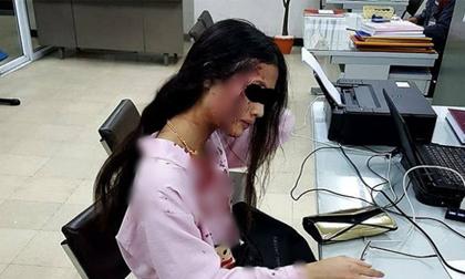 Cô gái Thái Lan bị bạn trai đánh đập dã man dù đang mang bầu 2 tháng