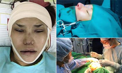 Nhìn loạt ảnh trong và sau quá trình 'dao kéo' mới thấy mỹ nhân Việt chịu đau giỏi như thế nào