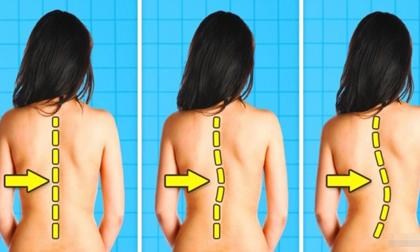 Những hoạt động hàng ngày có thể làm hại cột sống của bạn và cách khắc phục