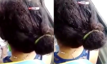 Mái tóc đầy côn trùng bò lúc nhúc khiến người xem bàng hoàng