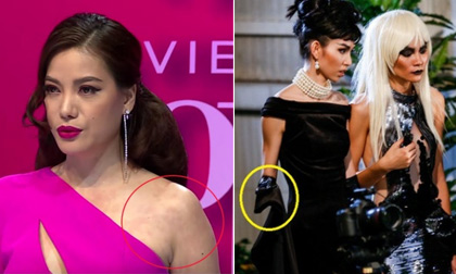 Nguyên nhân làn da mẩn đỏ của Trương Ngọc Ánh trên sóng truyền hình và bức ảnh 'mất tay' của Thùy Dương gây tranh cãi