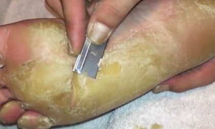 Clip cạo chai chân cực 'khủng' khiến hàng triệu cư dân mạng 'phát sốt'